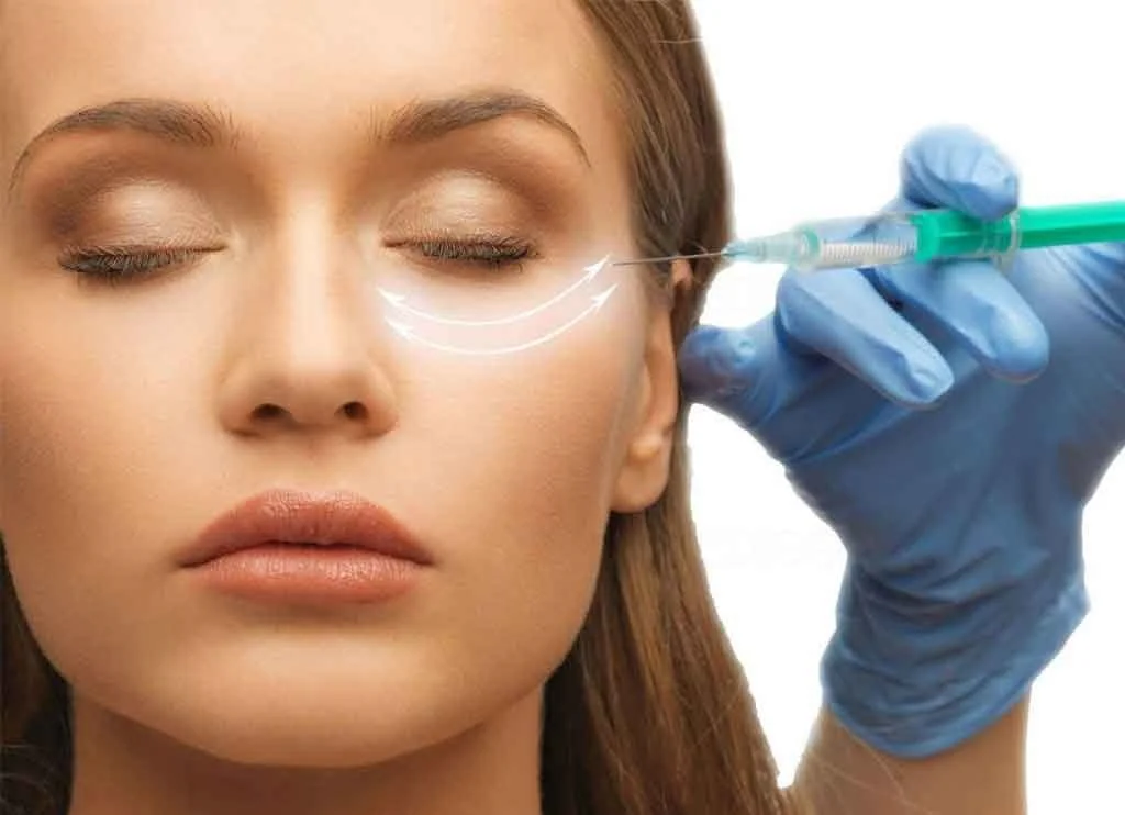 گودی زیر چشم