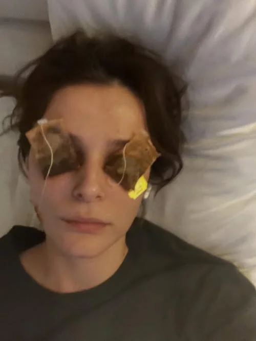 رفع پف چشم به شیوه بازیگر ترک