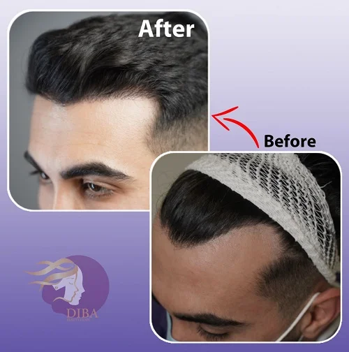 درمانگاه تخصصی پوست و مو دیبا