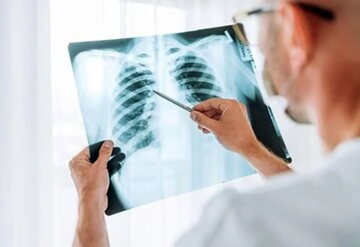 چرا آنفلوآنزا گاهی به قاتل خاموش تبدیل می‌شود؟