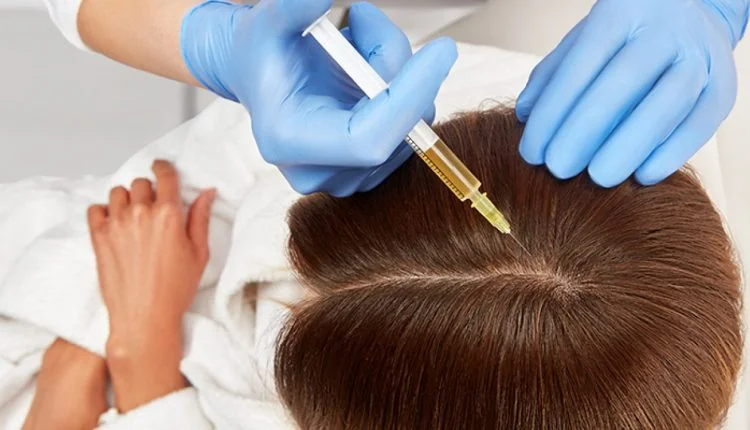 مکانیسم عملکرد PRP