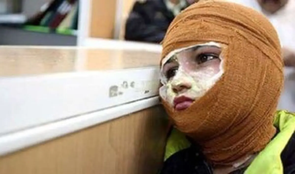 قیمت لباس‌های سوختگی از ۲ تا ۴۰ میلیون تومان؛ چرا درمان بیماران زیر ذره‌بین بیمه‌هاست؟