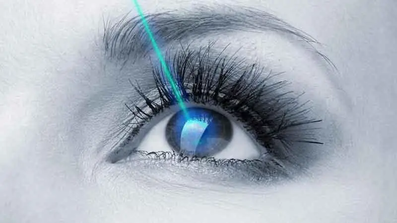 عمل جراحی لازک