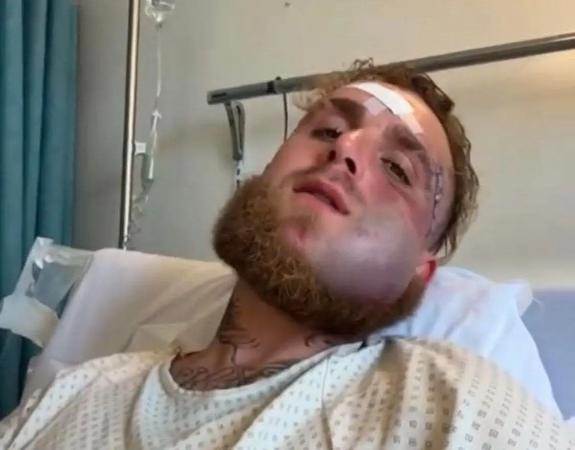 سیلی سهمگین جاشوا صورت پرادعای جیک پاول را به زمین کوبید!