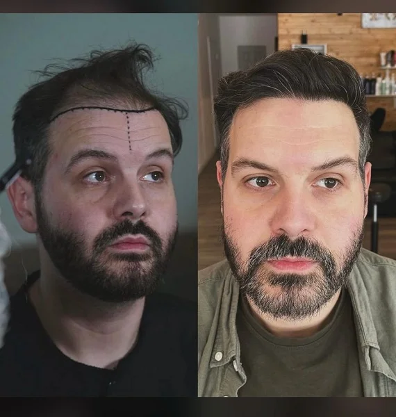 کلینیک زیبایی مهرا