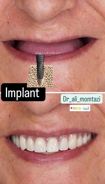 دکتر علی ممتازی