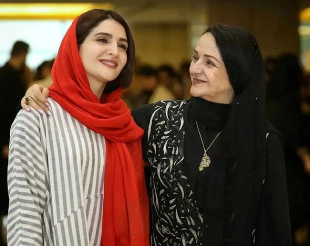 روایت متفاوت نورا هاشمی از عمل زیبایی‌ای که نمی‌خواست