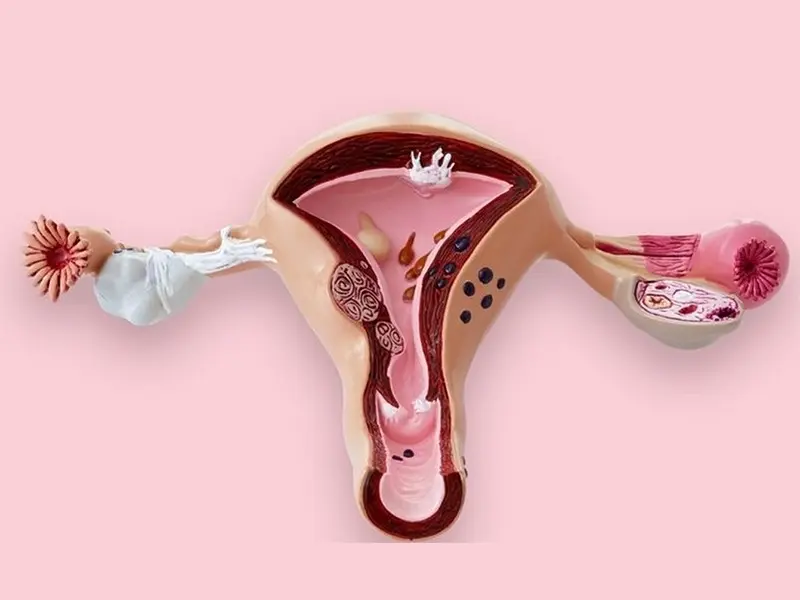 چه کسانی نمی‌توانند عمل جراحی لابیاپلاستی را انجام دهند؟