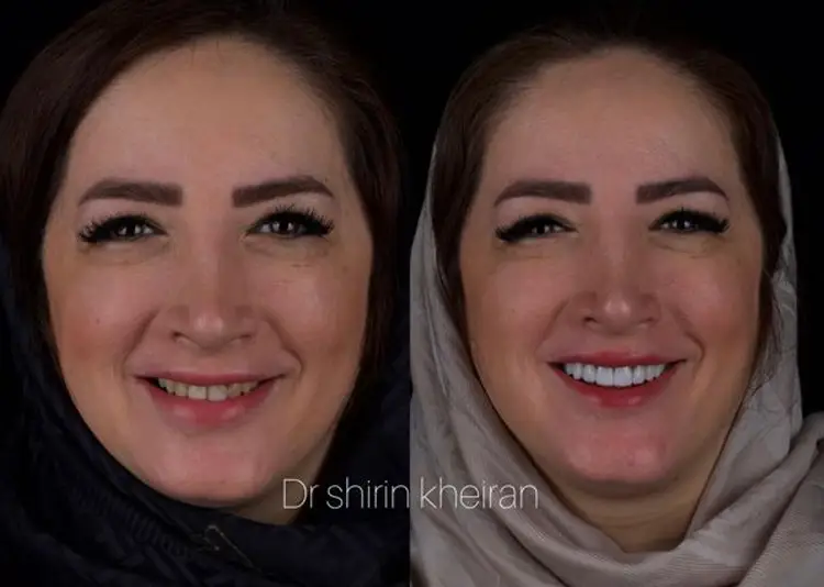 دکتر شیرین خیران – محدوده شمال تهران