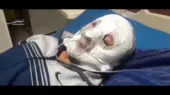 سوختگی صورت یک مامور انتظامی در کوهدشت/ ویدئو